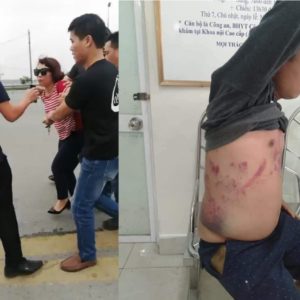 Đánh đập phụ nữ mang thai để bảo vệ “BOT bẩn”, công an huyện Sóc Sơn bị người dân tố cáo