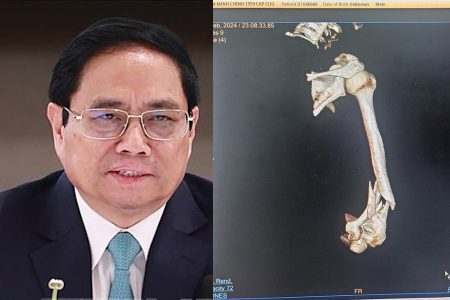 Prime Minister Pham Minh Chinh broke his arm: traffic accident or assassination?